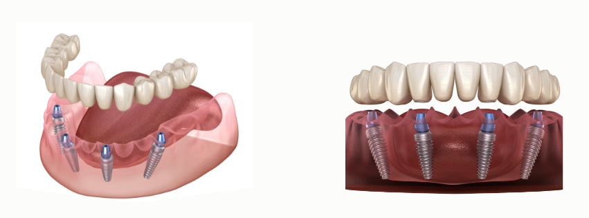 Untitled design - 2026-02-17T143933.866