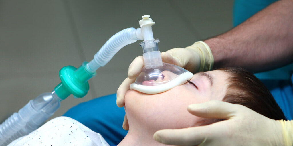 Child with an oxygen mask on his face. Preparing child for anesthesia. Dental treatment under general anesthesia. Dental surgery under general anesthesia. Surgical intervention. Side view.