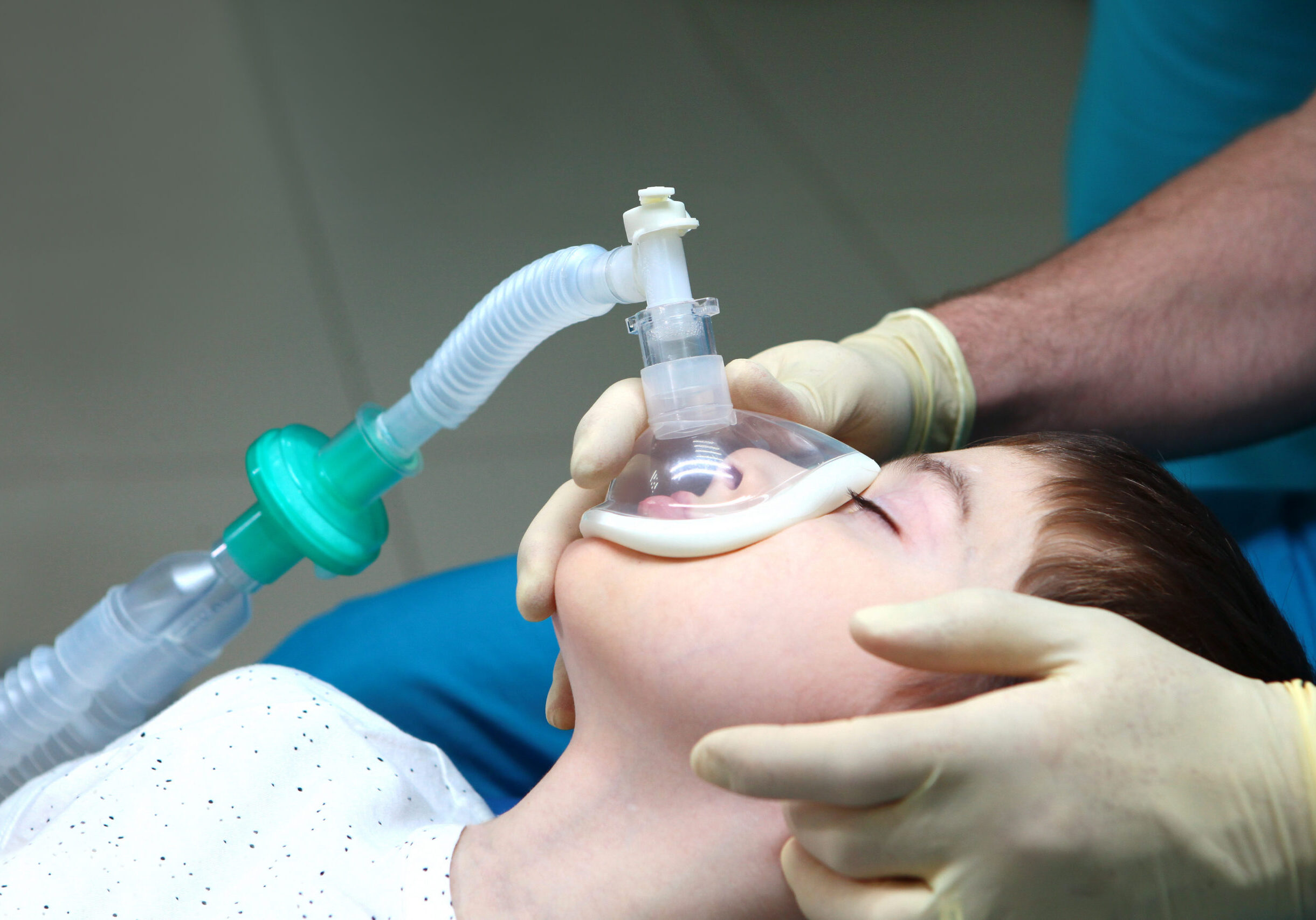 Child with an oxygen mask on his face. Preparing child for anesthesia. Dental treatment under general anesthesia. Dental surgery under general anesthesia. Surgical intervention. Side view.