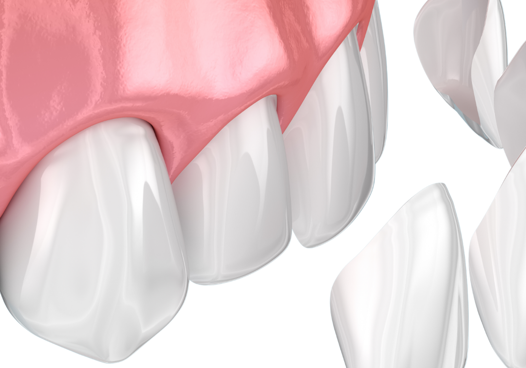 Untitled design - 2026-03-17T105909.000