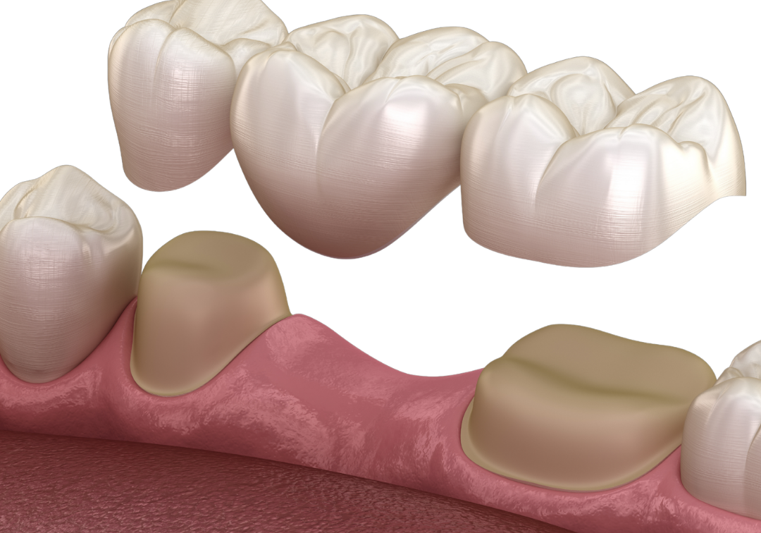 Untitled design - 2026-03-17T110404.233